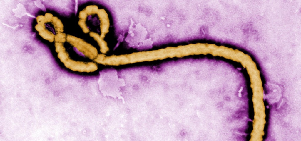 Los patógenos más temidos: 9 enfermedades que podrían causar una gran epidemia
