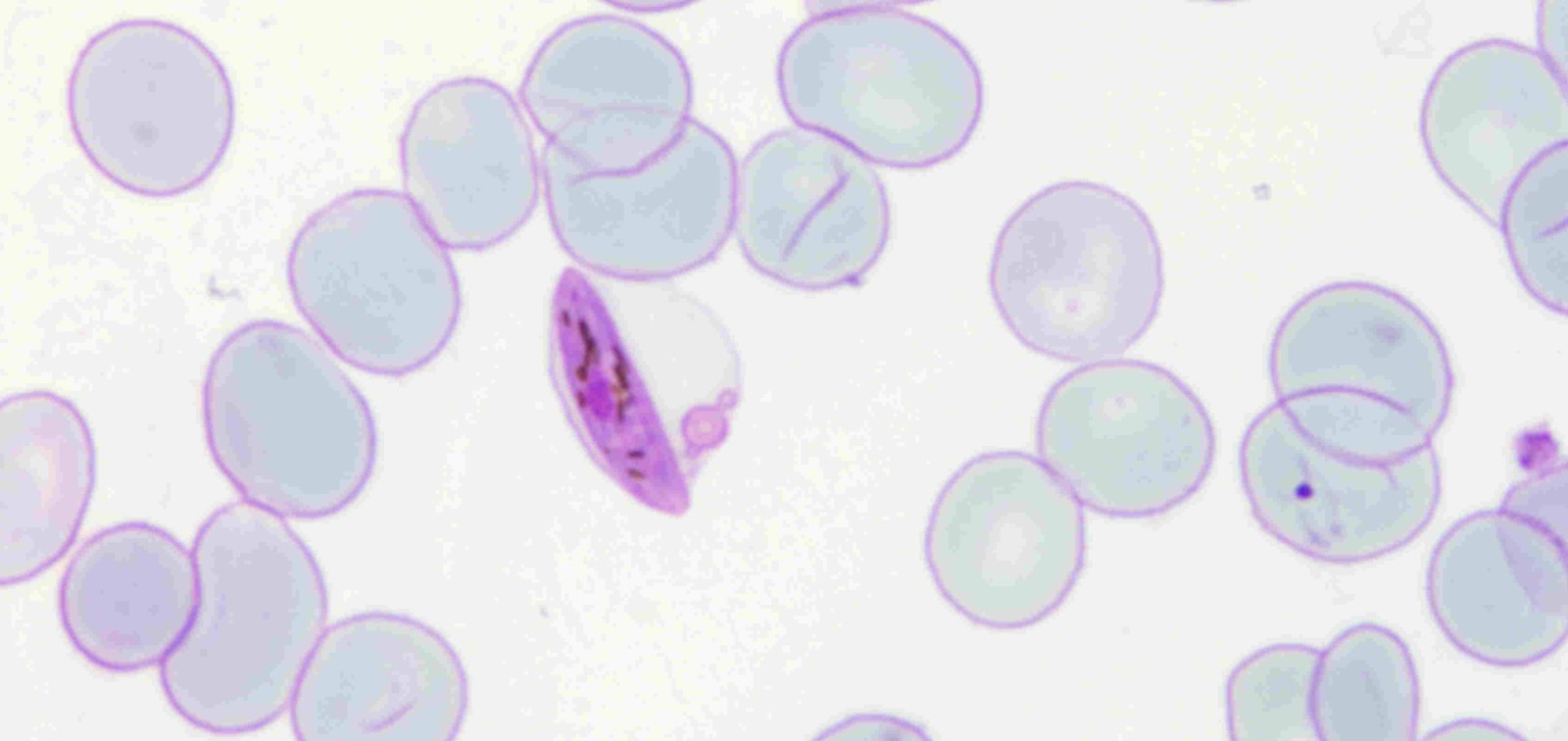 gametocito malaria parásito