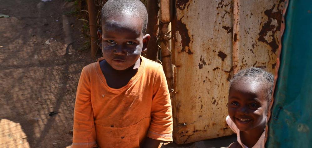 tuberculosi, sudàfrica