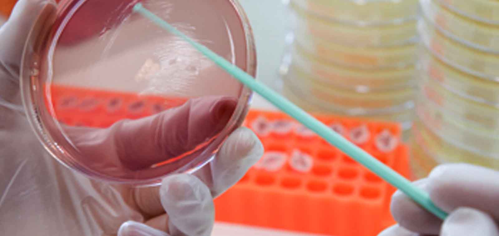 Resistencias Antimicrobianas