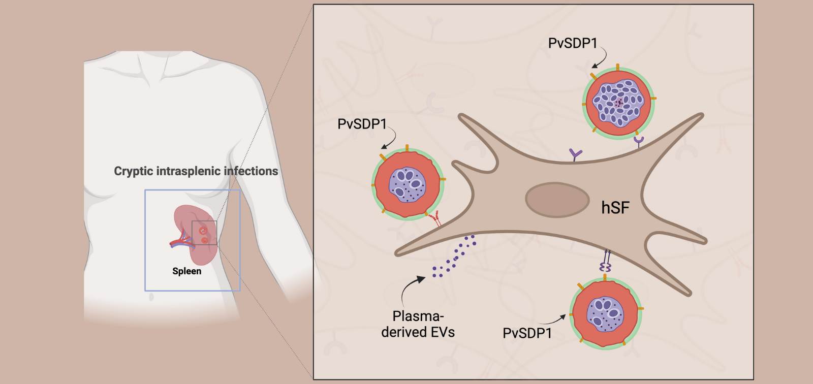 Infographic of Plasmodium vivax in the spleen.