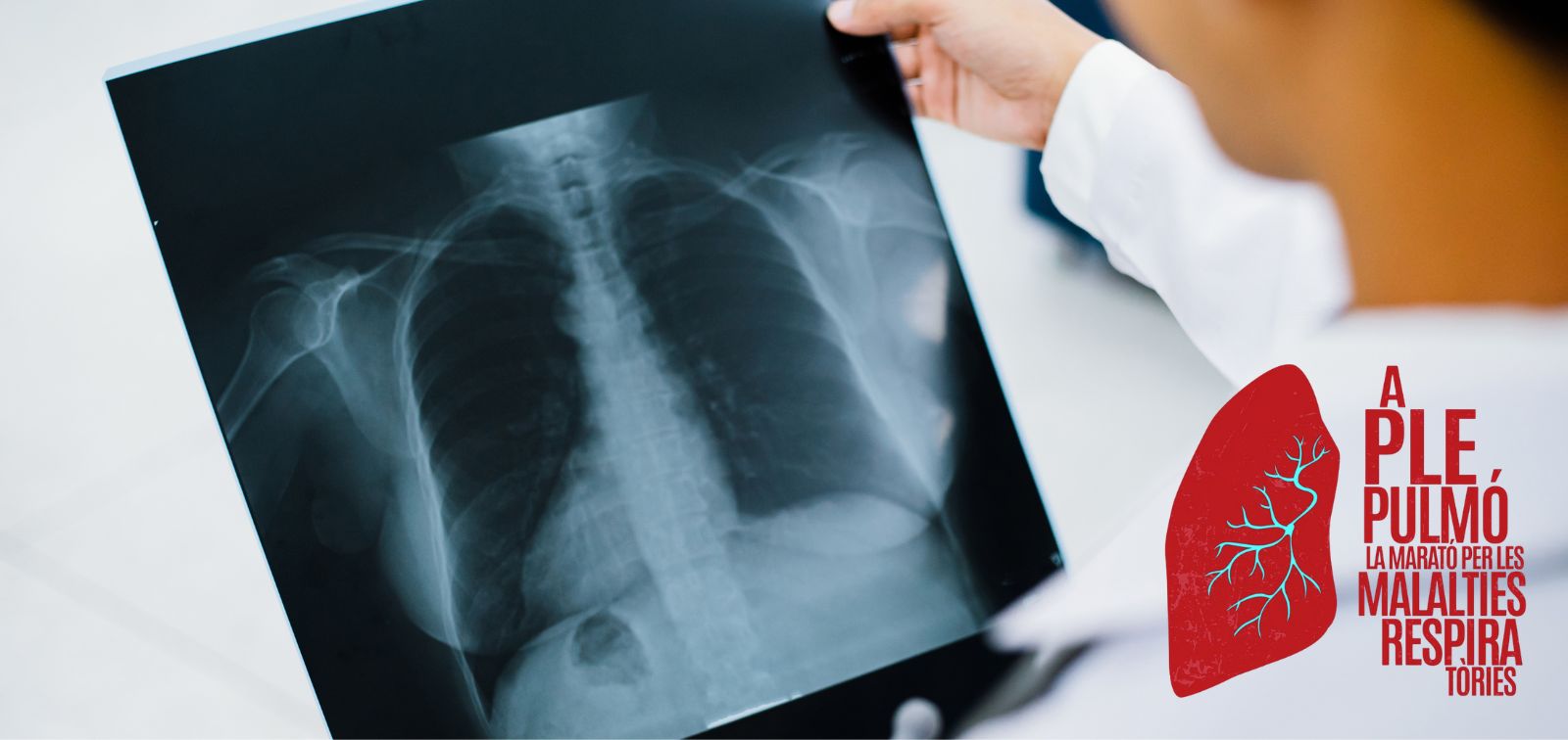 A doctor reviews a lung X-ray. At the bottom, the logo of La Marató de TV3 is shown.