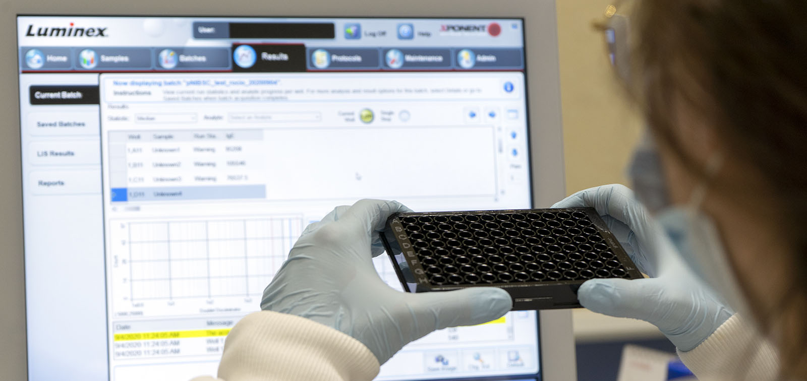 Respuesta inmunitaria y biomarcadores es uno de los cuatro Servicios Científicos de ISGlobal integrados en la plataforma CERCAGINYS.