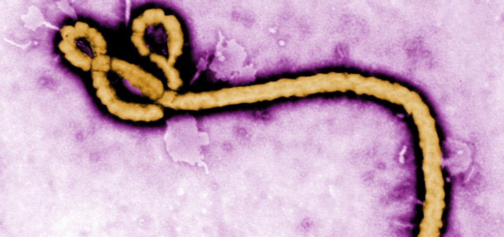 Ebola virus