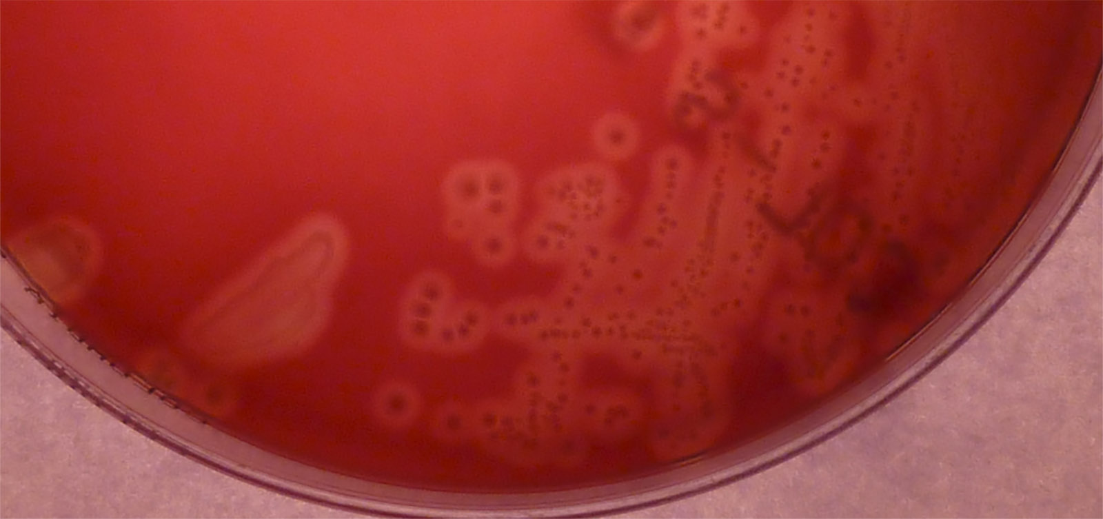 Group B Streptococcus (GBS) Trials and Tribulations Evento ISGLOBAL