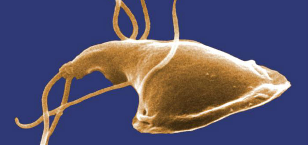 giardia resistente tratamiento)