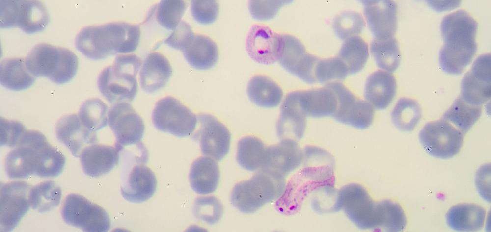 PLASMODIUM VIVAX: UNA INFECCIÓN CRÍPTICA QUE DESAFIA EL RETO DE LA ELIMINACIÓN DE MALARIA (CRYPTICVIVAX)