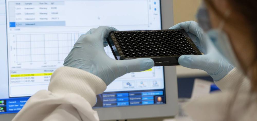 Uso de la tecnología Luminex para estudios inmunológicos