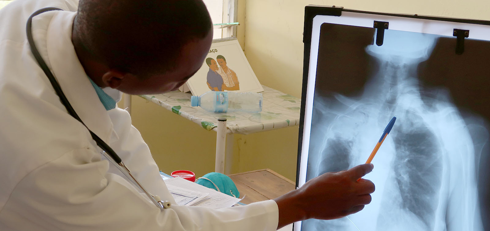 A CISM researcher observes the X-ray of a patient at the Manhiça Hospital, in Mozambique