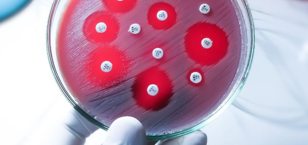 Antibiograma sobre un medio de cultivo para evaluar la sensibilidad de bacterias frente a diferentes discos de antibióticos.