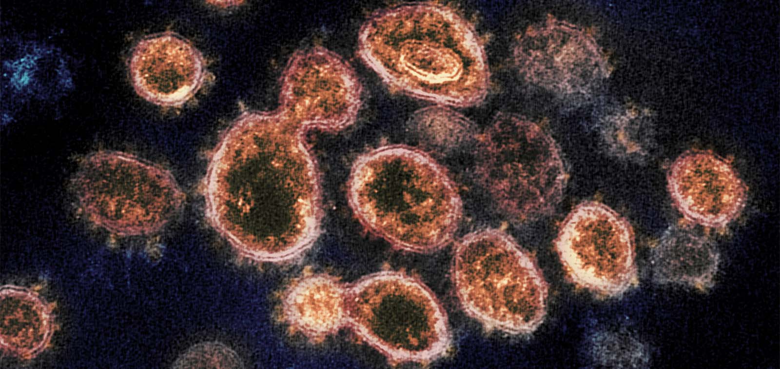SARS-CoV2 coronavirus by NIH Image Gallery