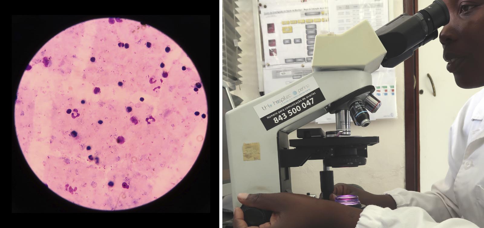 CISM researcher observes malaria parasite in blood under a microscope