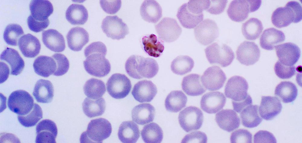 Esquizont madur de 'Plasmodium malariae'