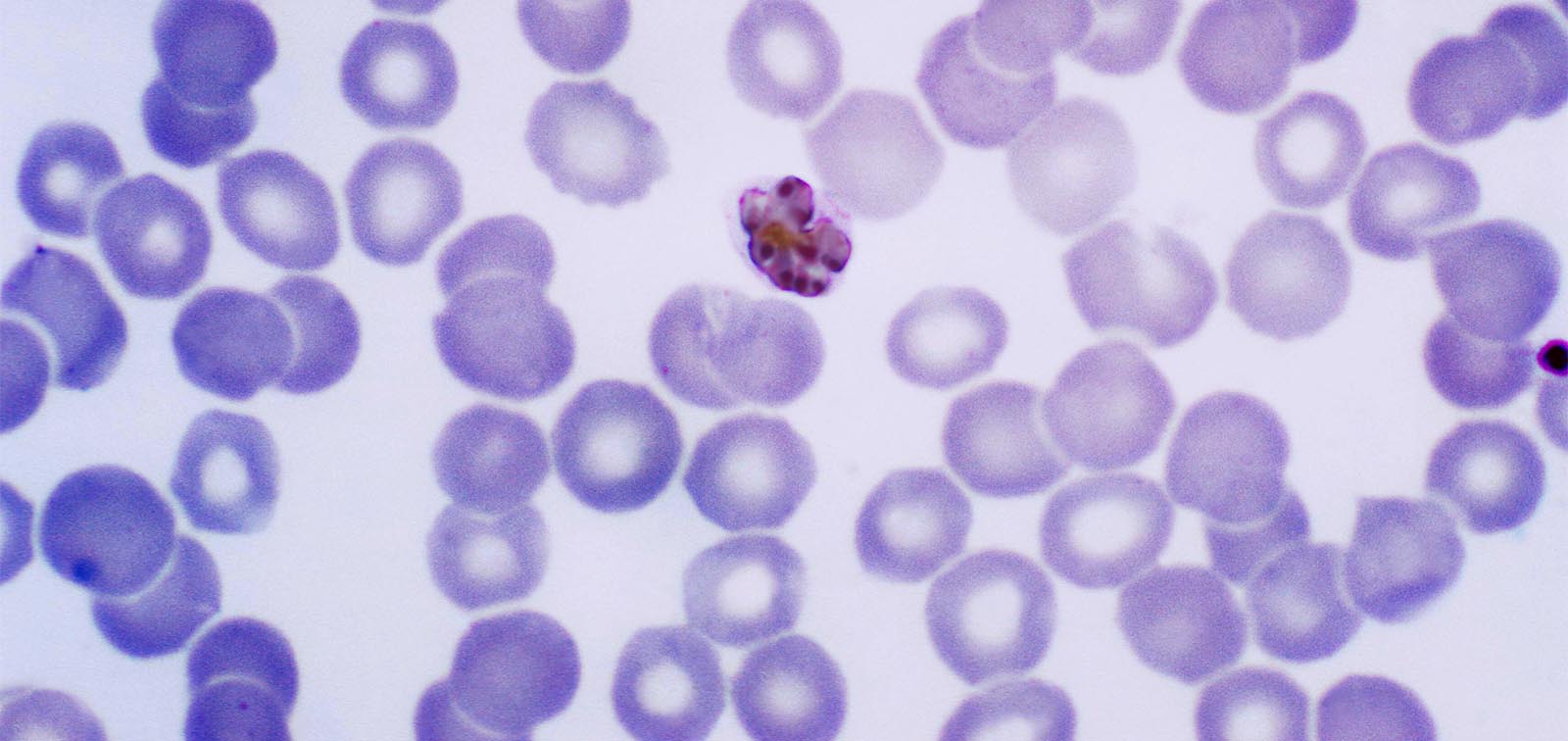 Esquizonte maduro de 'Plasmodium malariae'