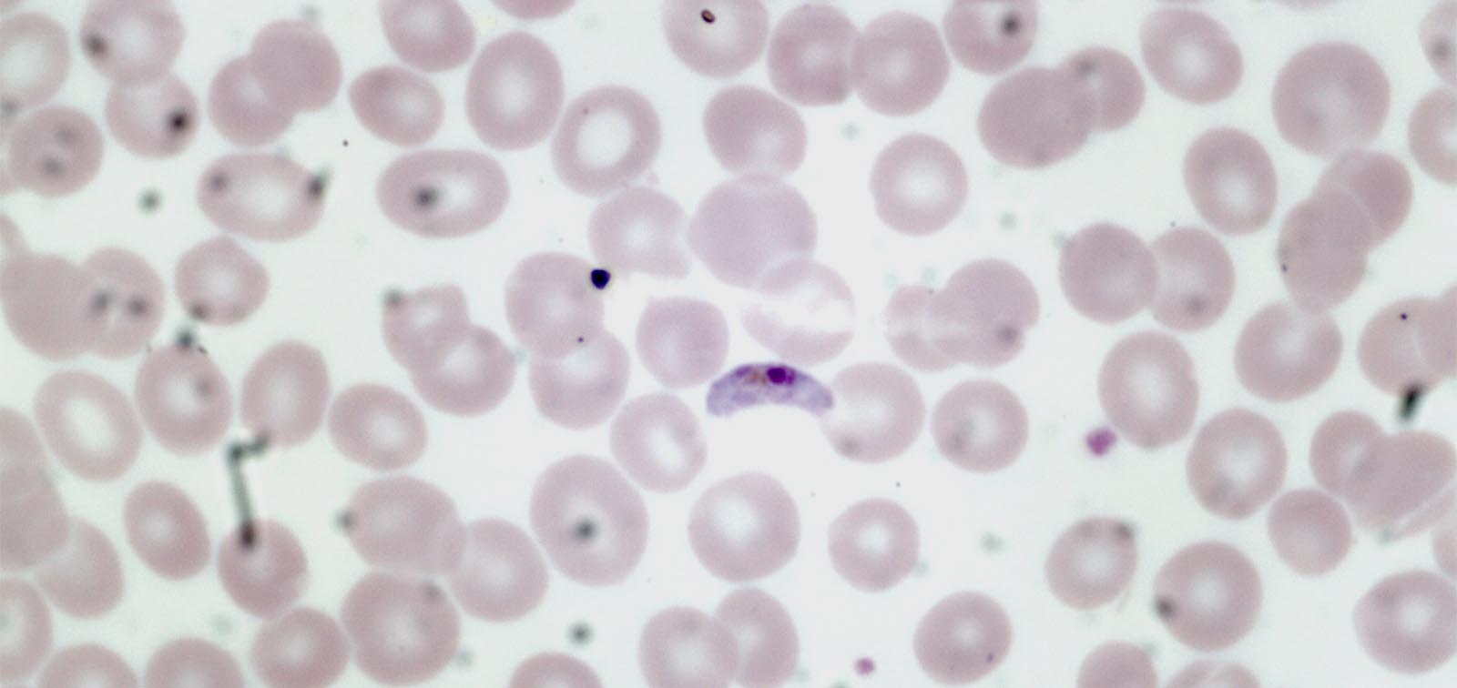 Plasmodium falciparum gametocyte