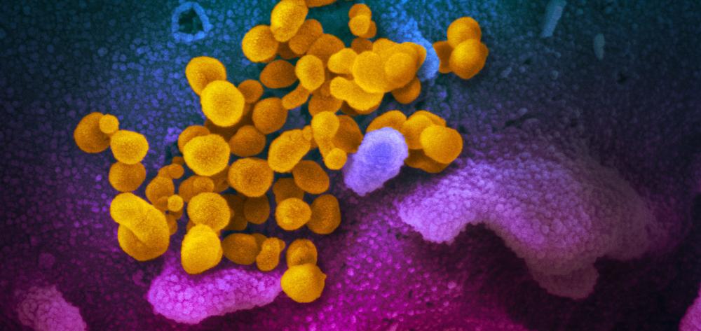 Novel Coronavirus SARS-CoV-2 - NIAID NIH