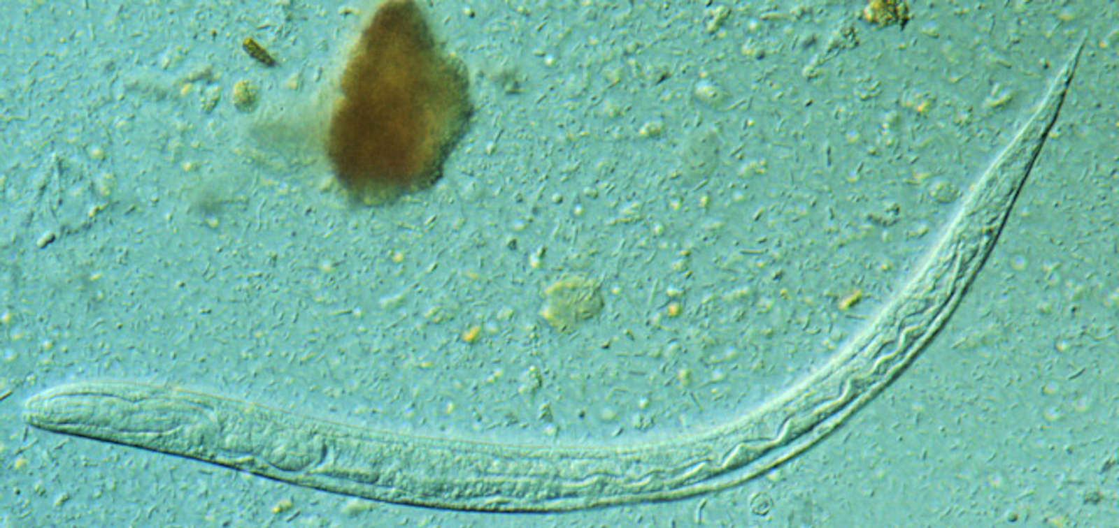 Larva de Strongyloides stercoralis