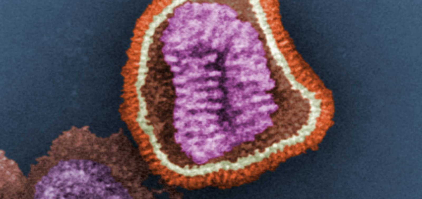 Influenza virus particle in color