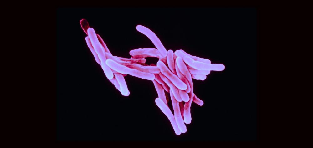 tuberculosi