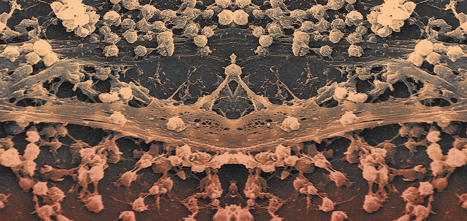 Biopelícula de Staphylococcus aureus